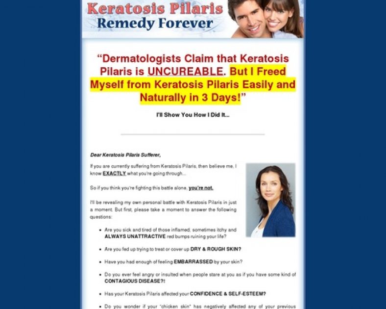 Keratosis Pilaris Treatment Endlessly  – The best way to Free Your self From Keratosis Pilaris Endlessly!