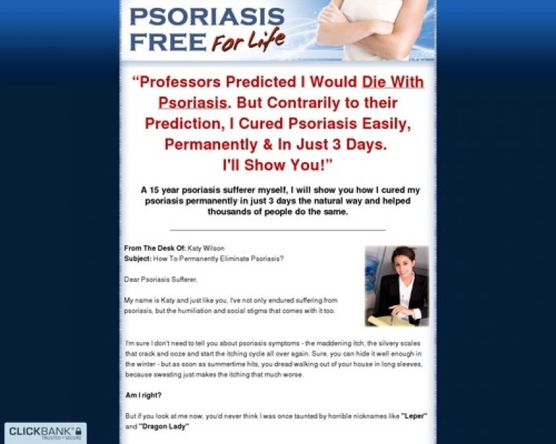 Psoriasis Treatment For Life – Tips on how to Treatment Psoriasis Simply, Naturally and For Life